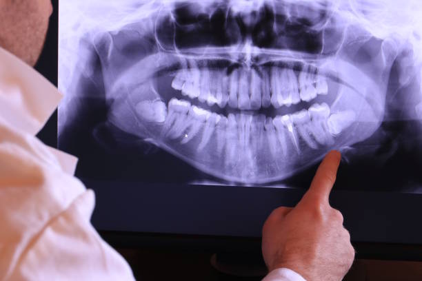 Best Pediatric Emergency Dentist in Mitchell, IN