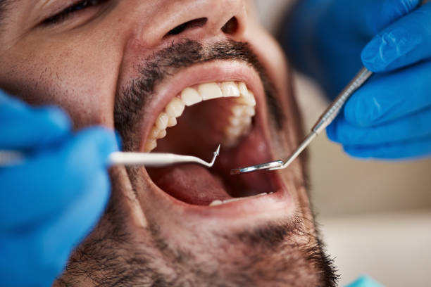 Best Urgent Dental Care for Toothache in Mitchell, IN