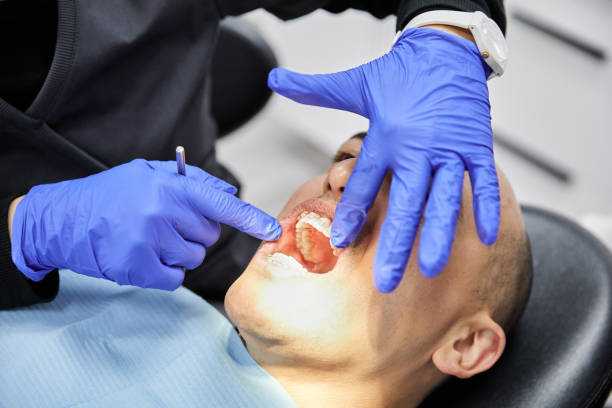 Best Emergency Root Canal Treatment in Mitchell, IN
