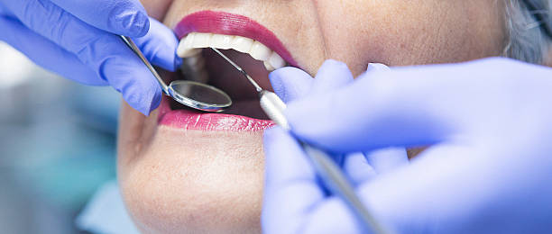 Best Emergency Root Canal Treatment in Mitchell, IN